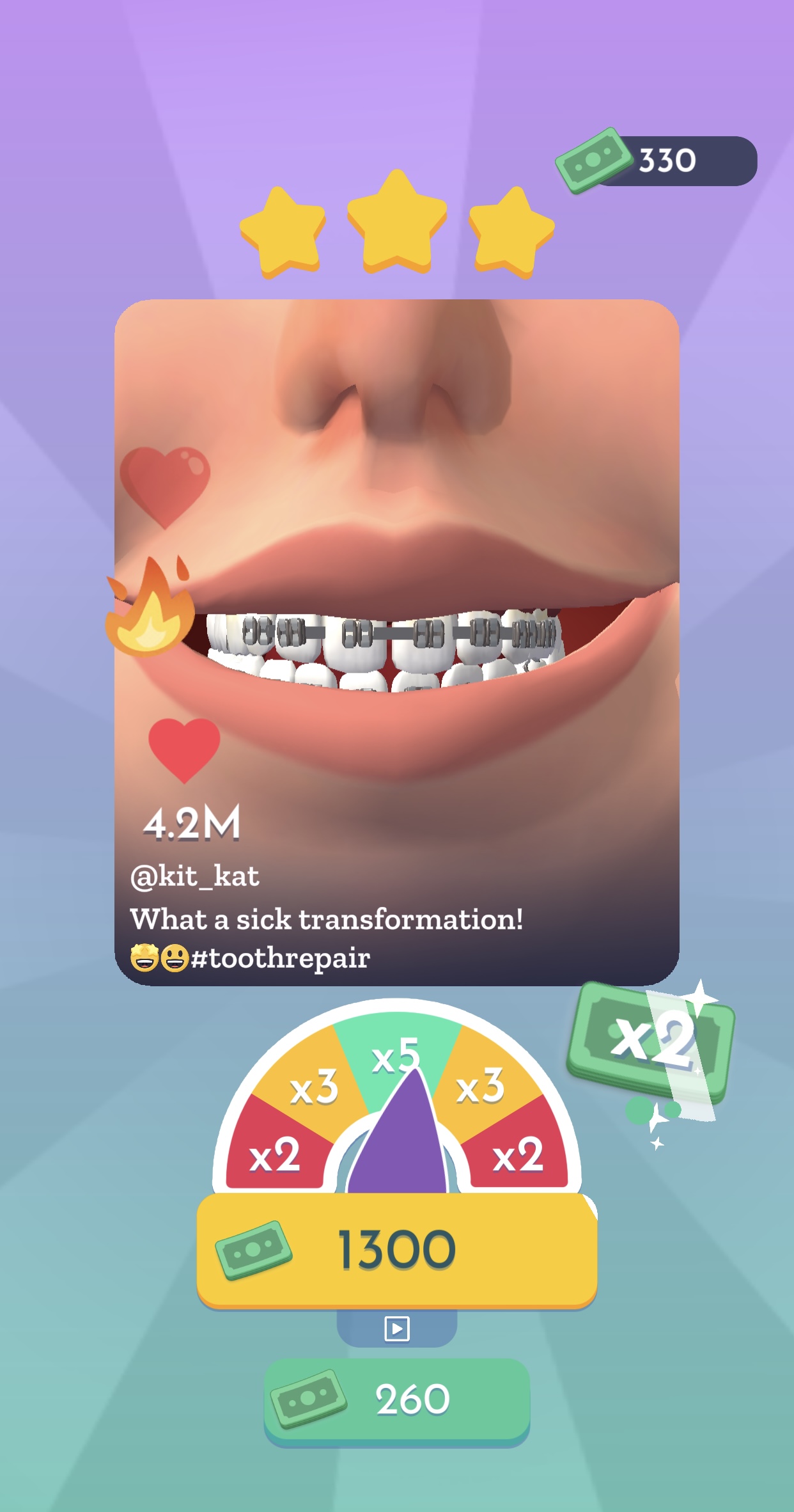 Perfect Smile Strategy Guide – Make Miles of Smiles With These Hints, Tips and Cheats